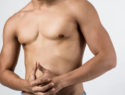 Bodybuilder’s Gynecomastia Correction